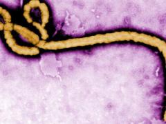 Disease caused by the Ebola virus is severe and often-fatal. Researchers at the Defense Advanced Research Projects Agency envision artificial intelligence systems that will accelerate the rate of research in chemistry, which could offer a wide range of benefits including the rapid discovery of cures for a range of diseases. Centers for Disease Control and Prevention photo by microbiologist Frederick A. Murphy, National Center for Infectious Diseases, Special Pathogens Branch