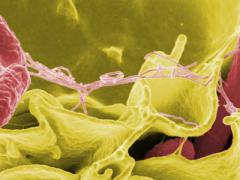 A color-enhanced typhimurium strain of salmonella (red) invades cultured human cells. The hundreds of microbes living on and in the human body have proven to be surprisingly unique.