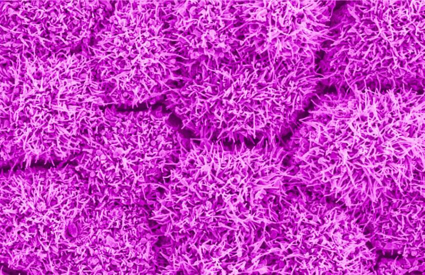 Researchers at the National Institutes of Health applied artificial intelligence (AI) to a technique that produces high-resolution images of cells in the eye. They report that with AI, imaging is 100 times faster and improves image contrast 3.5-fold. The advance, they say, will provide researchers with a better tool to evaluate age-related macular degeneration and other retinal diseases. Image & caption by National Institutes of Health