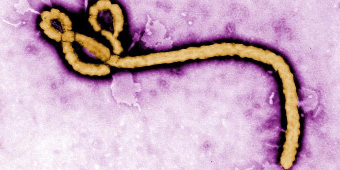 Disease caused by the Ebola virus is severe and often-fatal. Researchers at the Defense Advanced Research Projects Agency envision artificial intelligence systems that will accelerate the rate of research in chemistry, which could offer a wide range of benefits including the rapid discovery of cures for a range of diseases. Centers for Disease Control and Prevention photo by microbiologist Frederick A. Murphy, National Center for Infectious Diseases, Special Pathogens Branch
