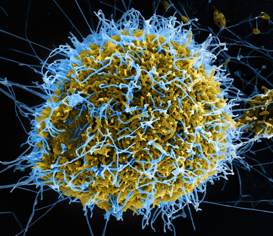 Ebola virus particles, in blue, bud from a chronically infected kidney Vero E6 cell, in yellow-green. Combining classified signals intelligence with open-source data may enhance the intelligence community’s ability to predict major disease outbreaks.