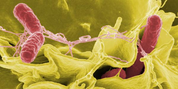 A color-enhanced typhimurium strain of salmonella (red) invades cultured human cells. The hundreds of microbes living on and in the human body have proven to be surprisingly unique.