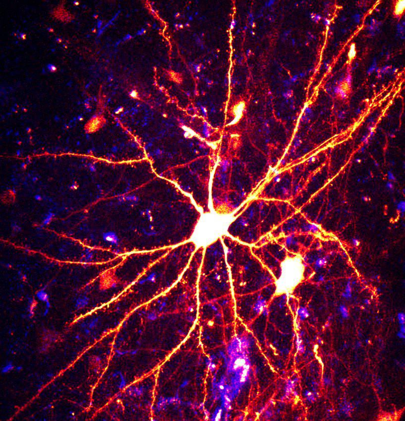 Cognitive computing advances will enable computers to process vast amounts of data like the brains of humans or animals.